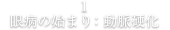 眼病の始まり:動脈硬化