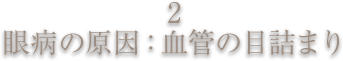 眼病の原因:血管の目詰まり