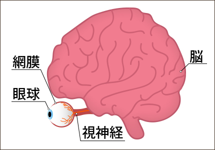 血管の目詰まり